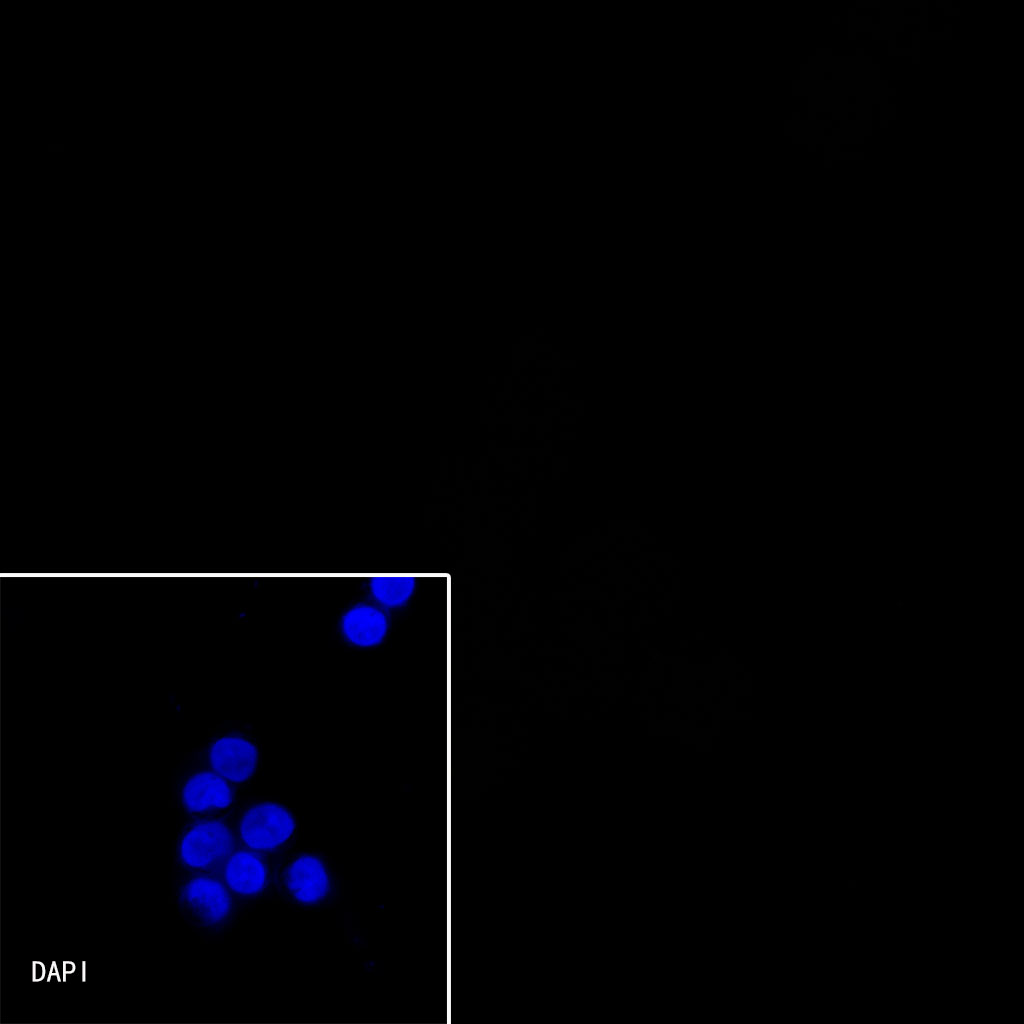 CD138 Recombinant Rabbit mAb (SDT-R120)