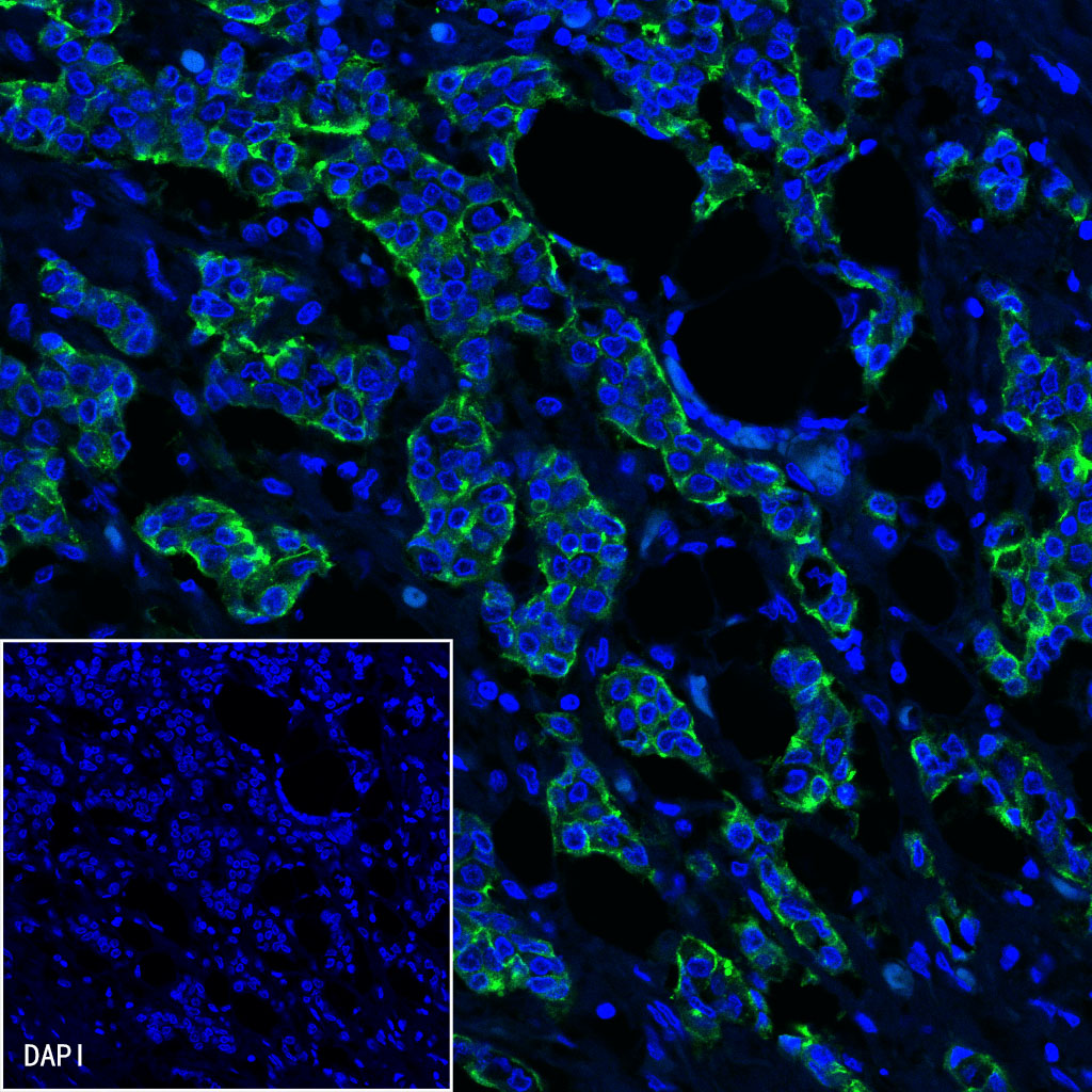 S-RMab® MUC1 Recombinant Rabbit mAb (SDT-776-49)