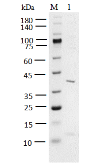 JAK3(JH1) Protein