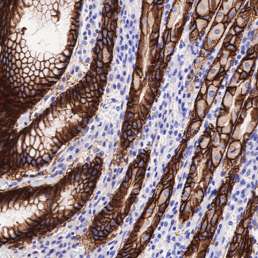 Claudin18.2 + Claudin18.1 Recombinant Rabbit mAb (SDT-298-29)