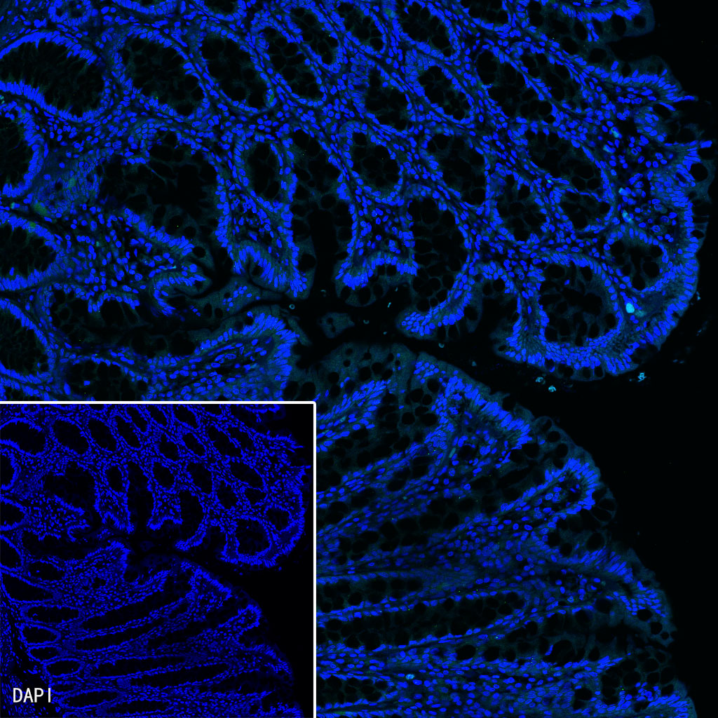 S-RMab® MUC6 Recombinant Rabbit mAb (SDT-081-72)