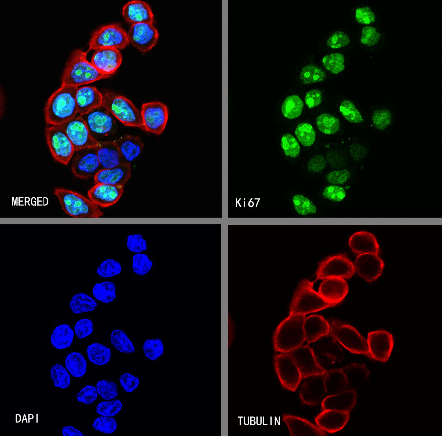 Ki67 Recombinant Mouse mAb (SDT-606-7)