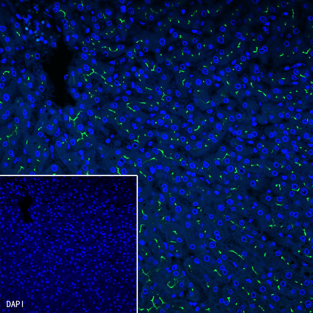 BSEP Recombinant Rabbit mAb (SDT-045-13)