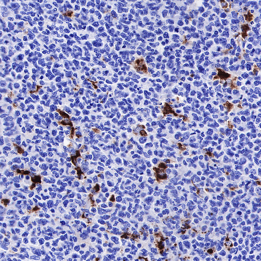 S-RMab® CD68 Recombinant Mouse mAb (SDT-R146)