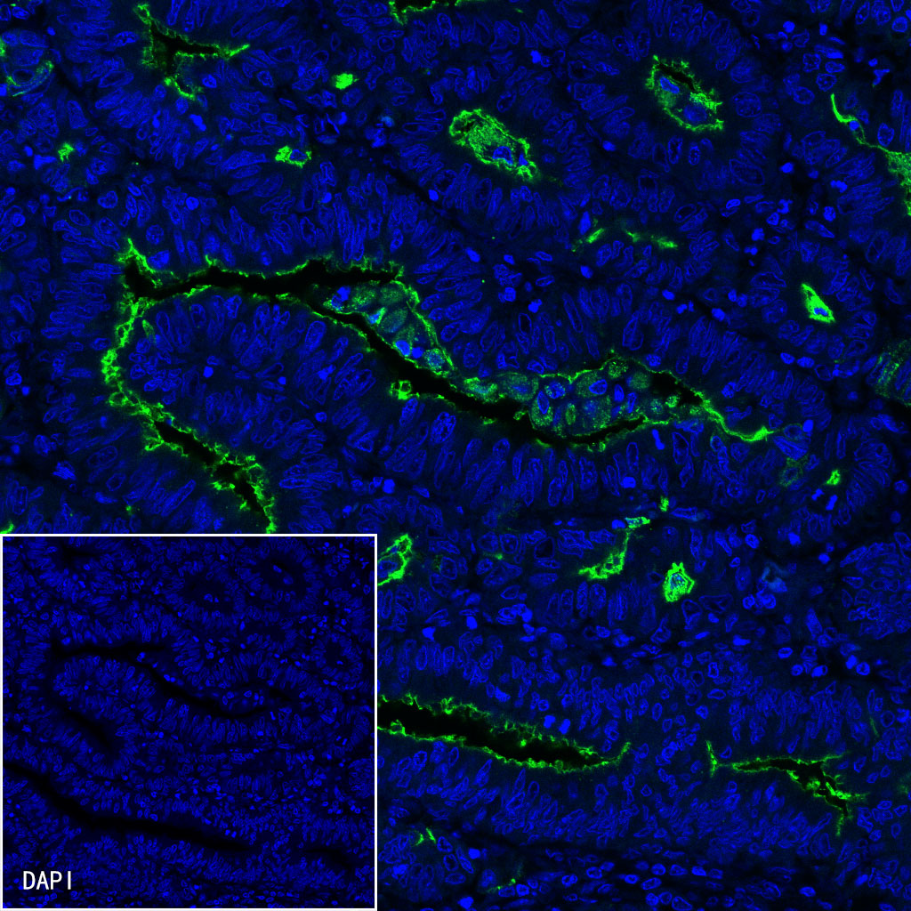 S-RMab® MUC1 Recombinant Rabbit mAb (SDT-776-49)