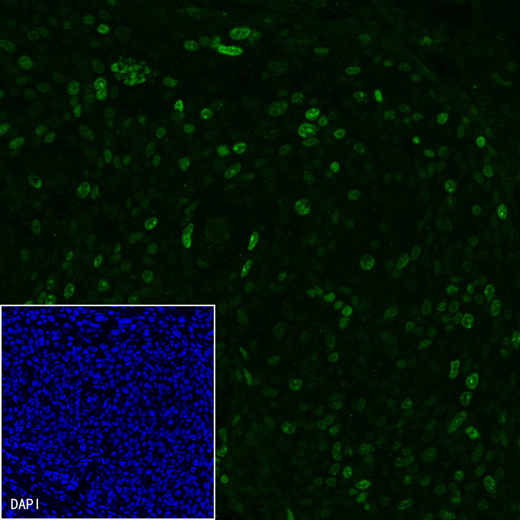 Ki67 Recombinant Mouse mAb (SDT-606-7)