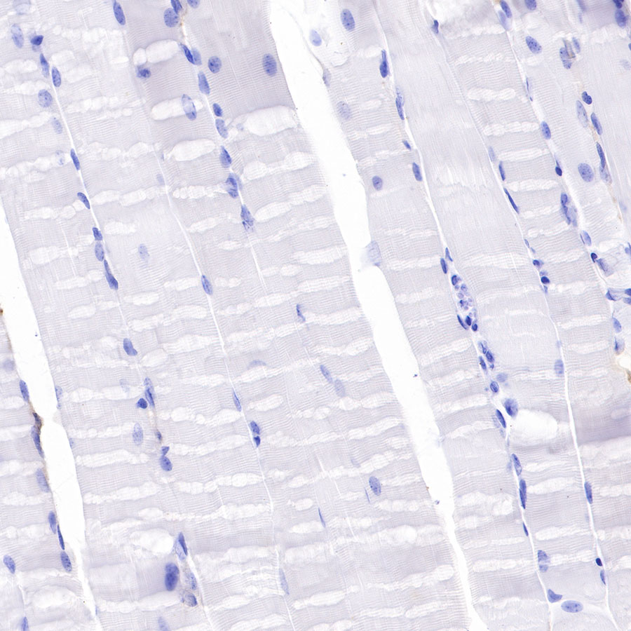 F4/80 Recombinant Rabbit mAb (SDT-313-49)