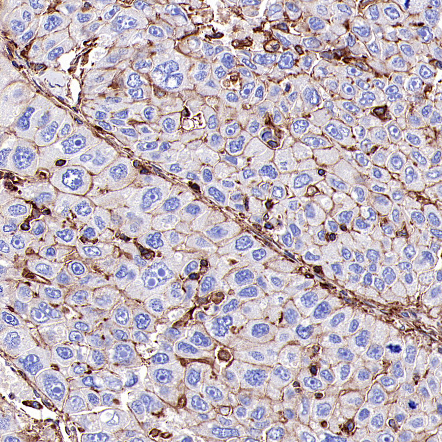 β-actin Recombinant Rabbit mAb (SDT-R156)