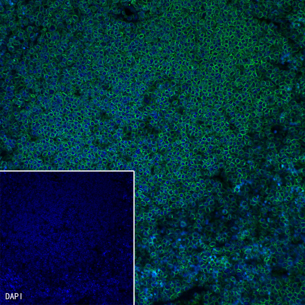 Lamin B1 Recombinant Rabbit mAb (SDT-307-108)