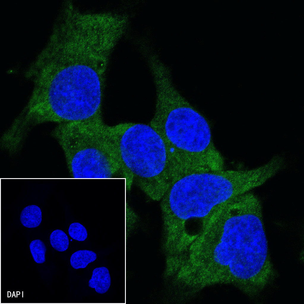 SPAM1 (U14) Rabbit mAb main image 0