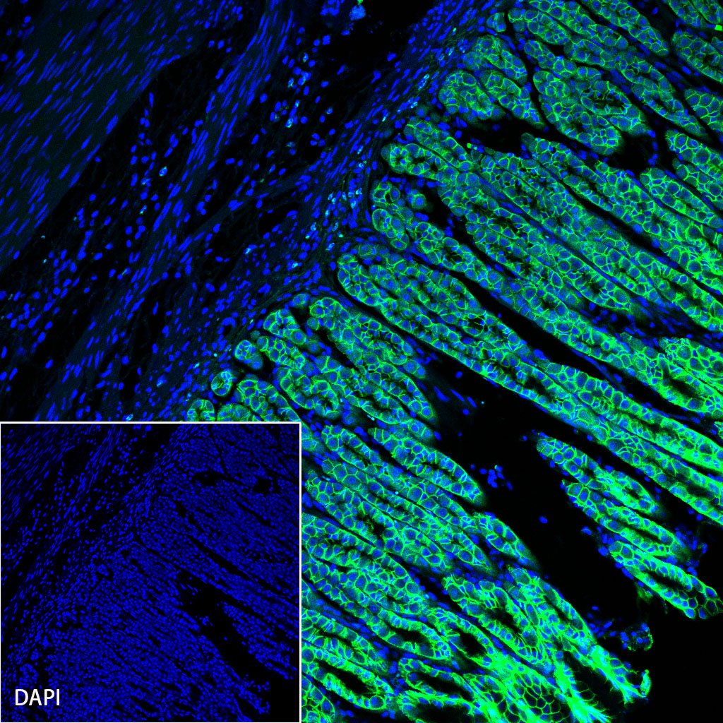 Claudin 18.2 Recombinant Rabbit mAb (Alexa Fluor® 488 Conjugate) (SDT-102-24)