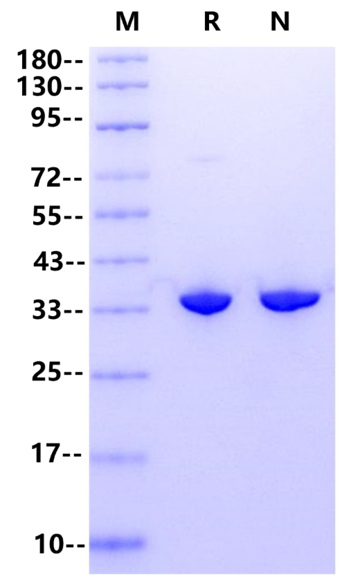 Pyrophosphatase, Inorganic(无机焦磷酸酶)
