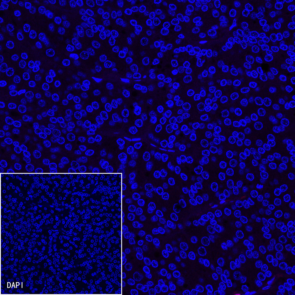 Goat anti-Rabbit IgG(H+L) (Alexa Fluor® 594 Conjugate)