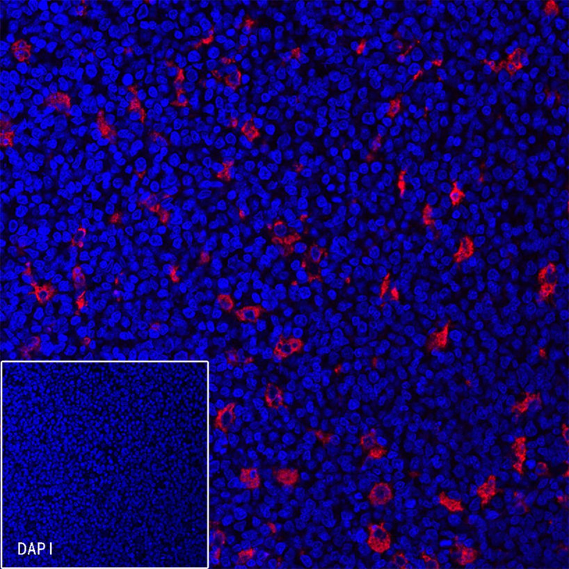 Rabbit anti-CD68 Recombinant Monoclonal Antibody(R025)