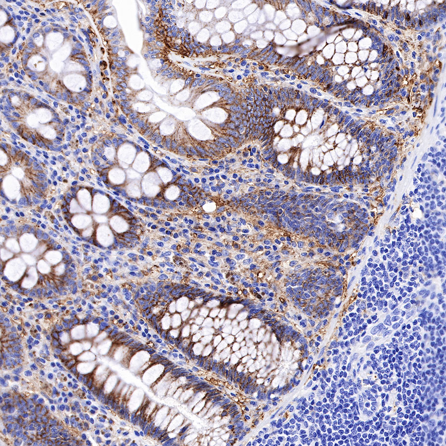 CD138 Recombinant Rabbit mAb (SDT-R120)