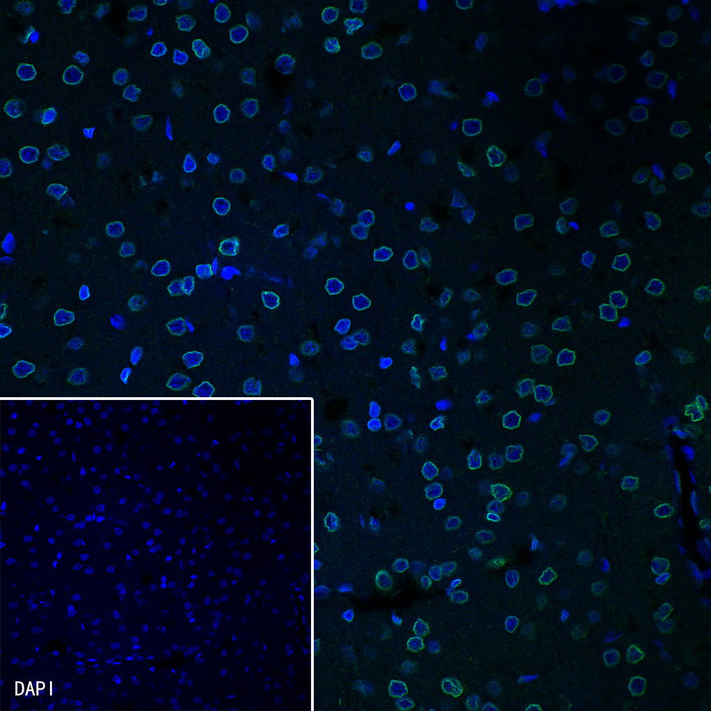 Lamin B1 Recombinant Rabbit mAb (SDT-307-108)