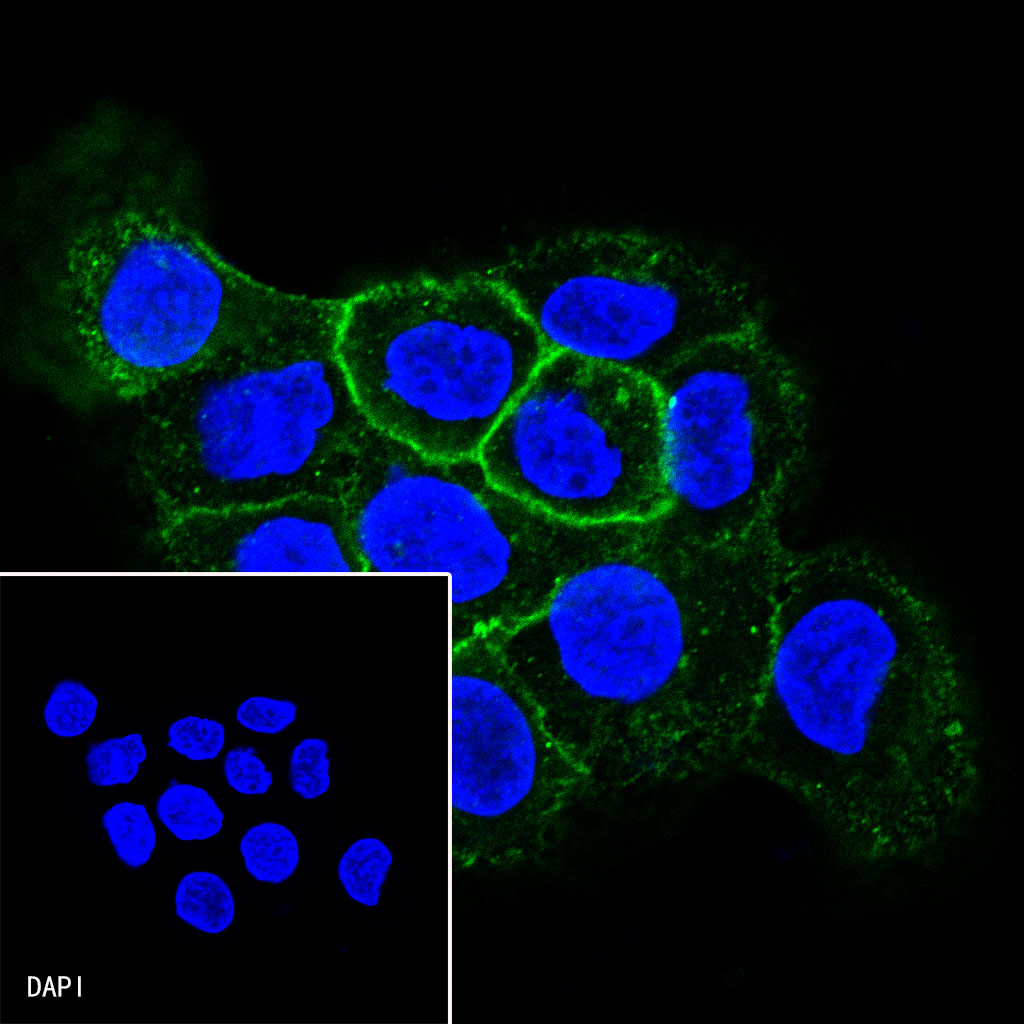 CD138 Recombinant Rabbit mAb (SDT-R120)