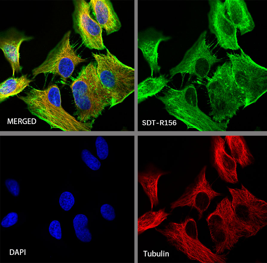 β-actin Recombinant Rabbit mAb (SDT-R156)