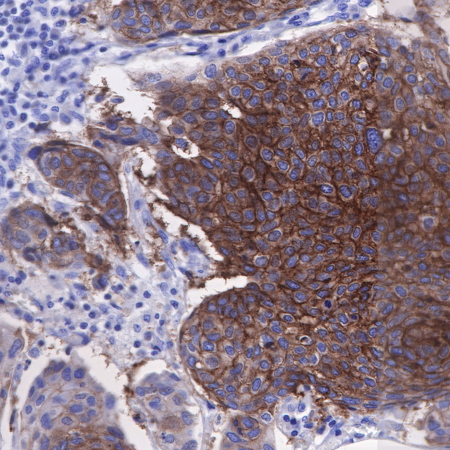 CD49b / Integrin alpha 2 Recombinant Rabbit mAb (SDT-399-52)