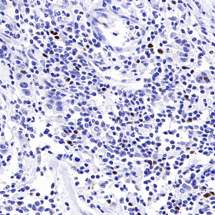 Mouse anti-FOXP3 Recombinant Monoclonal Antibody(R149)
