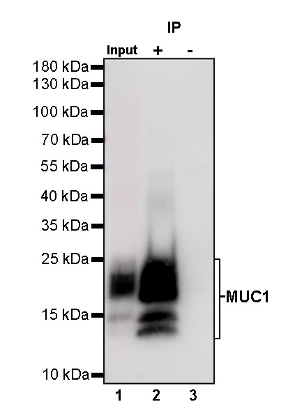 S-RMab® MUC1 Recombinant Rabbit mAb (SDT-776-49)