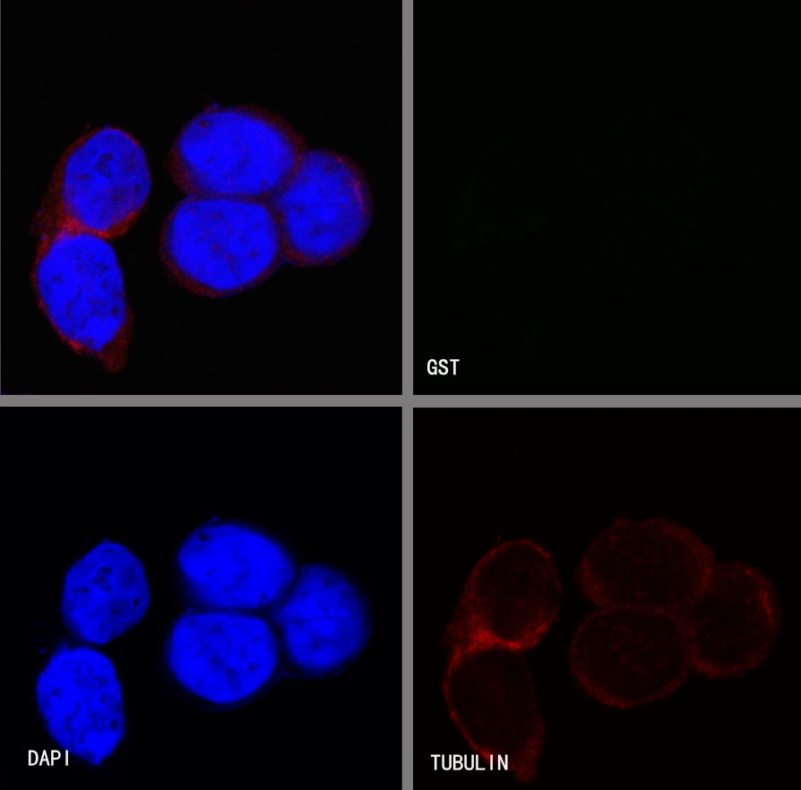 GST Tag Recombinant Rabbit mAb (S-372-19)