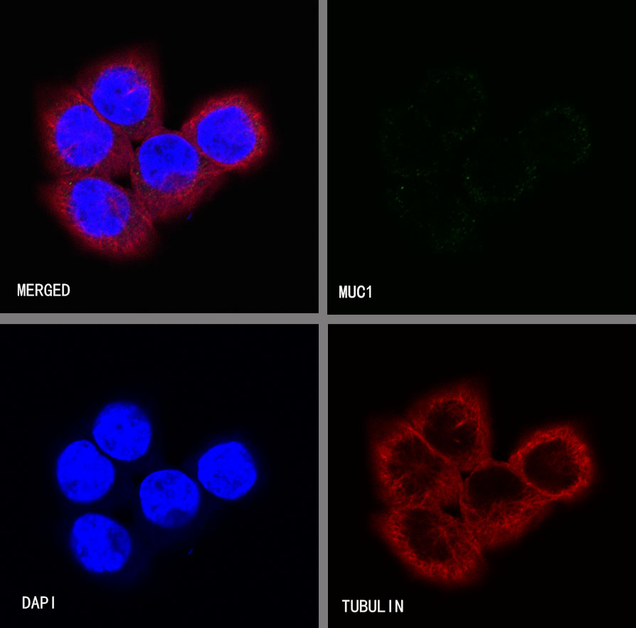 S-RMab® MUC1 Recombinant Rabbit mAb (SDT-776-49)