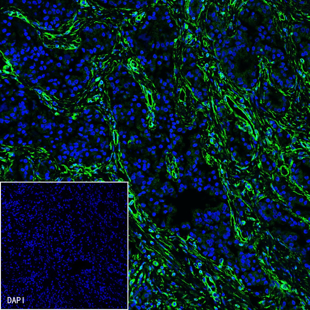 Rabbit anti-Vimentin Monoclonal Antibody(029-20)