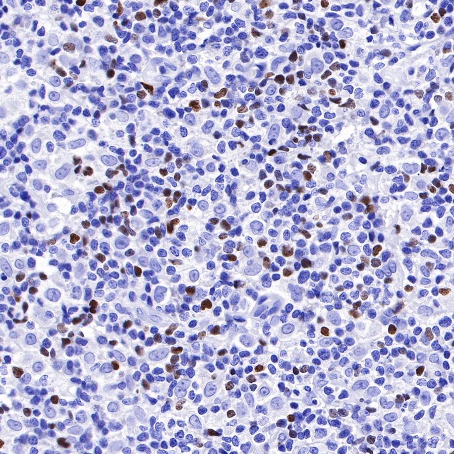 Mouse anti-FOXP3 Recombinant Monoclonal Antibody(R149)