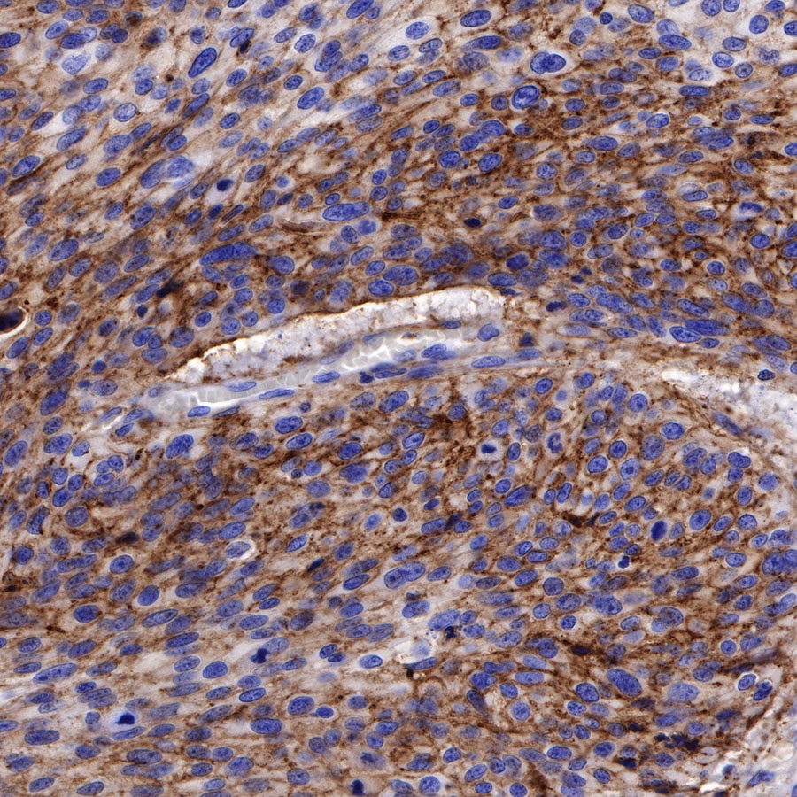 CD138 Recombinant Rabbit mAb (SDT-R120)