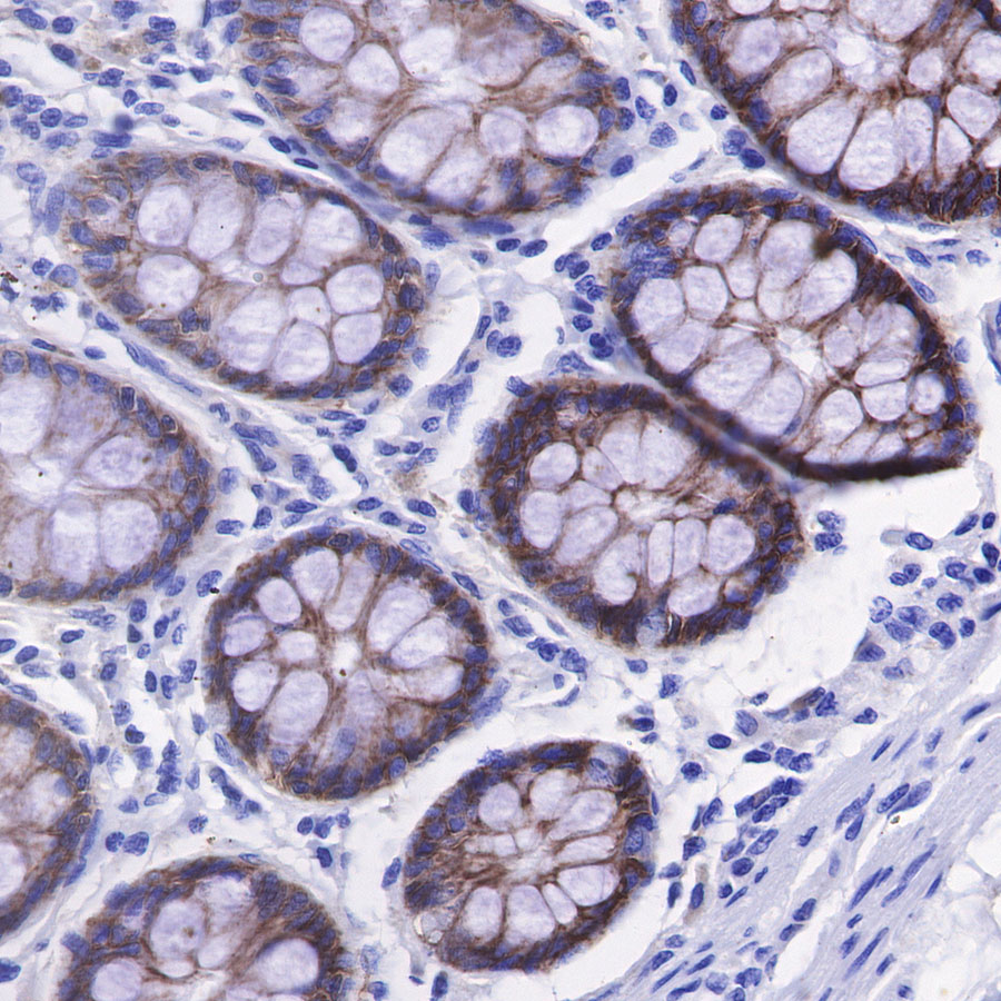 CD49b / Integrin alpha 2 Recombinant Rabbit mAb (SDT-399-52)