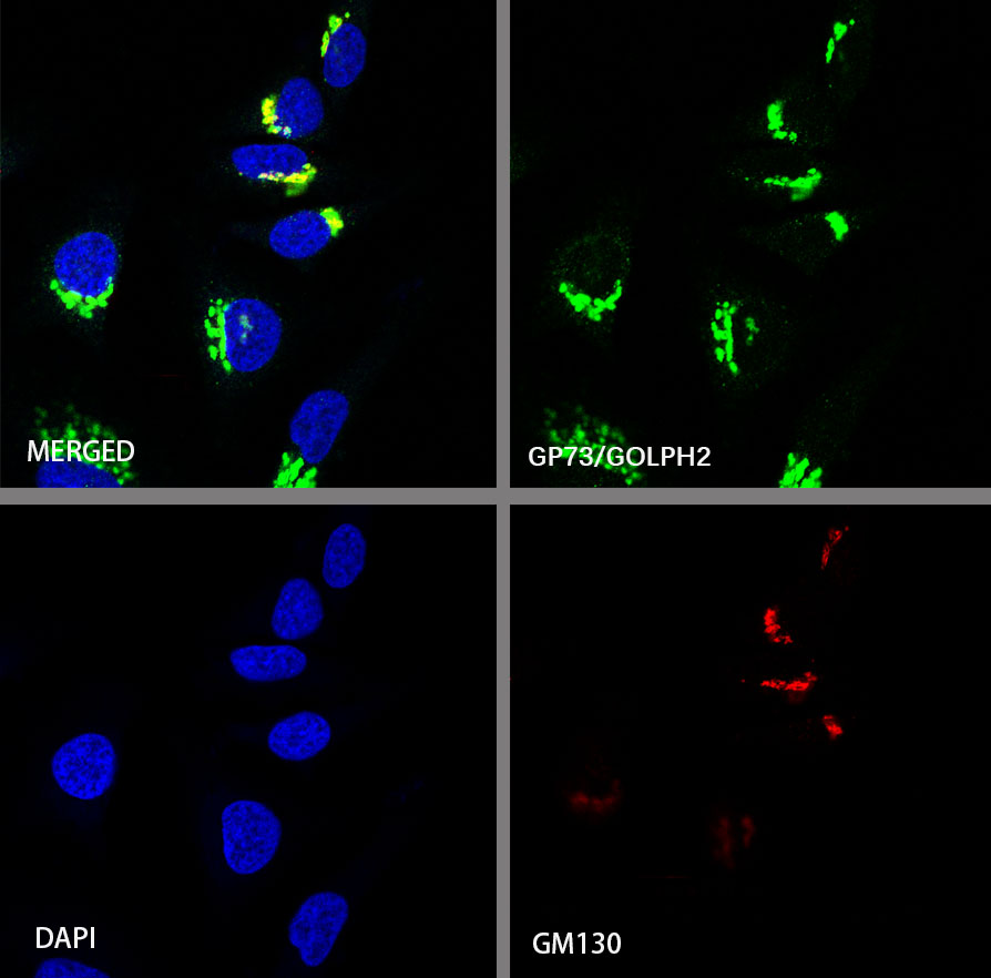 GP73/GOLPH2 Recombinant Rabbit mAb (SDT-231-102)