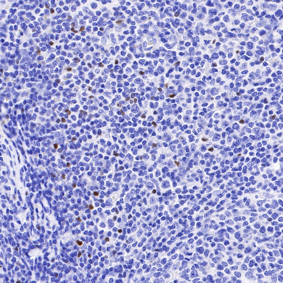 Mouse anti-FOXP3 Recombinant Monoclonal Antibody(R149)