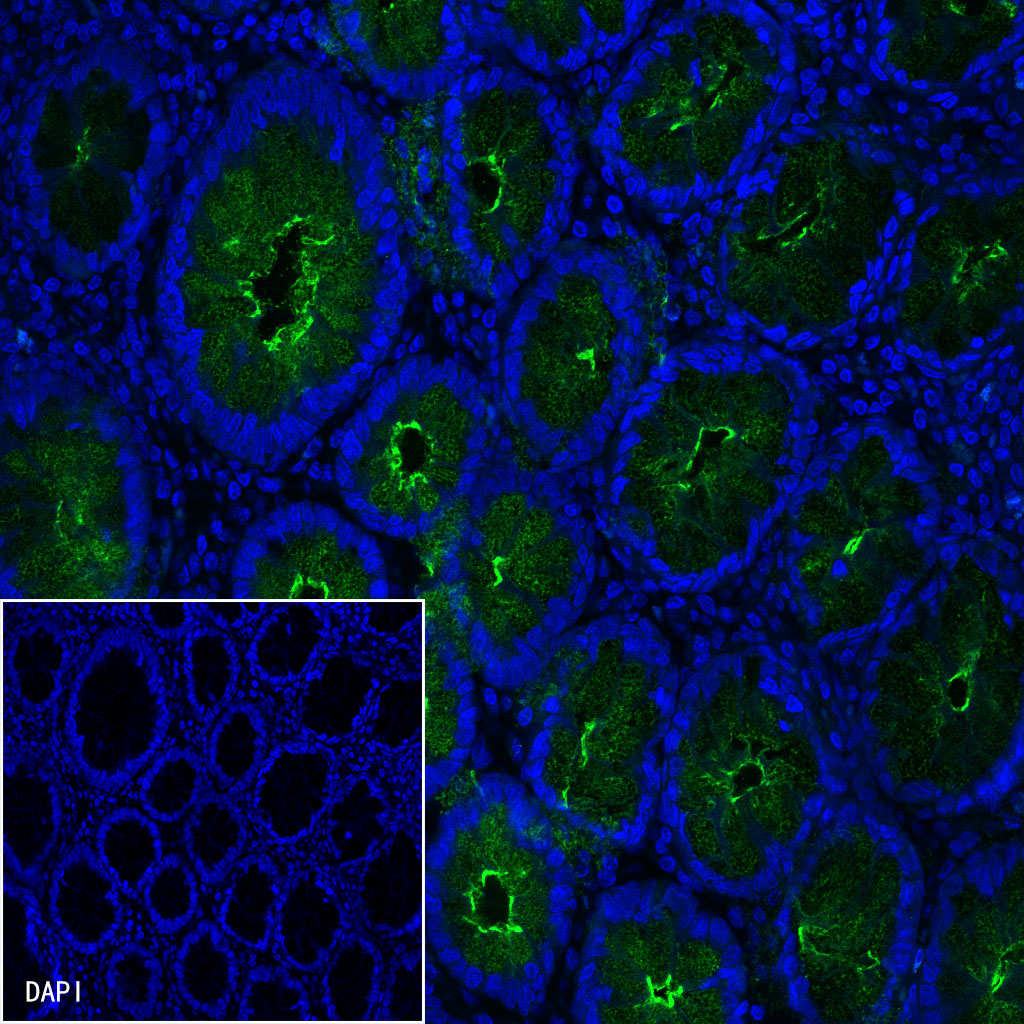 S-RMab® MUC1 Recombinant Rabbit mAb (SDT-776-49)
