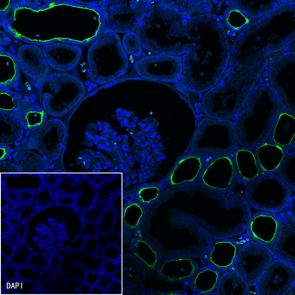 S-RMab® MUC1 Recombinant Rabbit mAb (SDT-776-49)