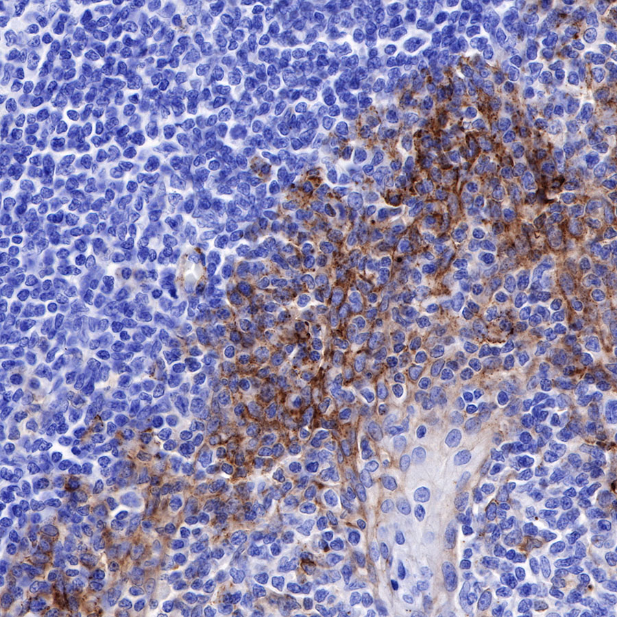 CD138 Recombinant Rabbit mAb (SDT-R120)