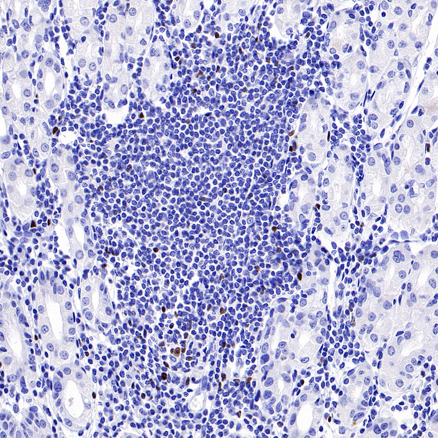 Mouse anti-FOXP3 Recombinant Monoclonal Antibody(R149)