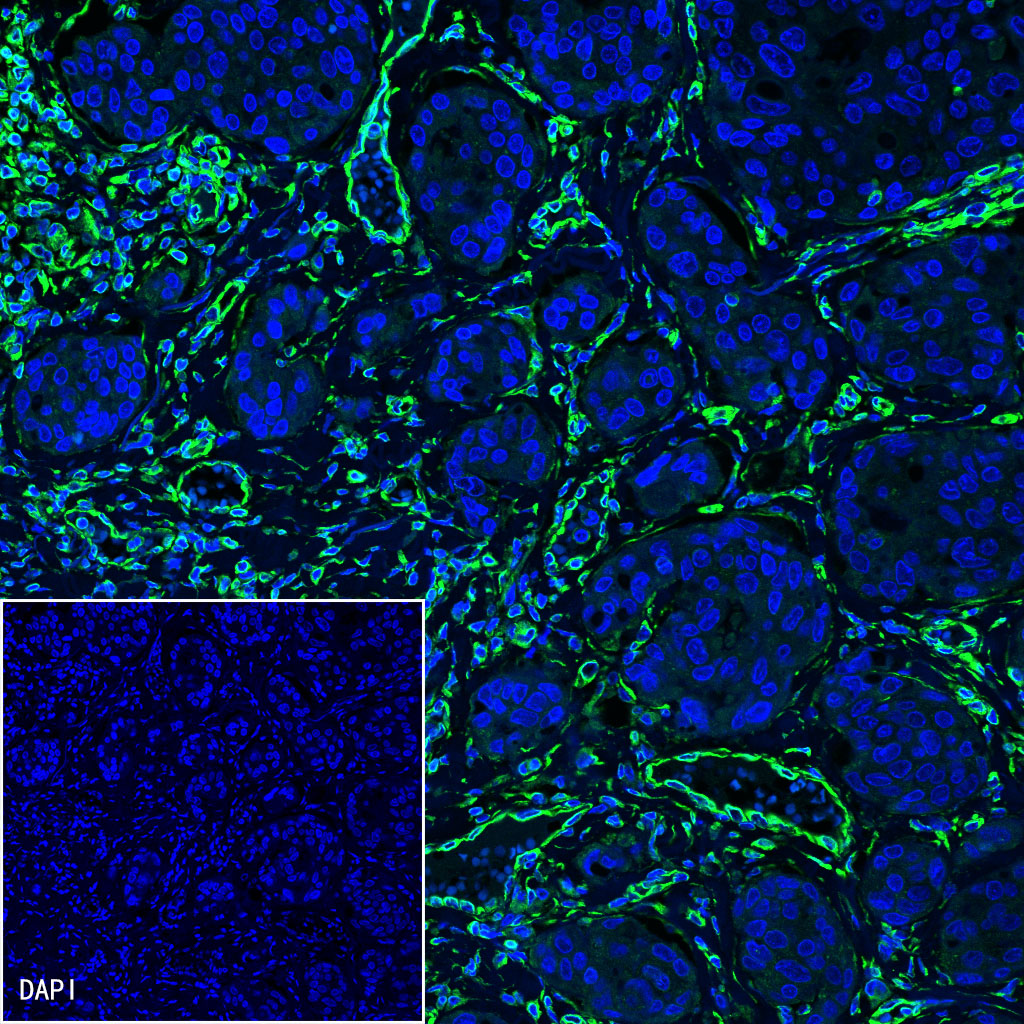 Rabbit anti-Vimentin Monoclonal Antibody(029-20)