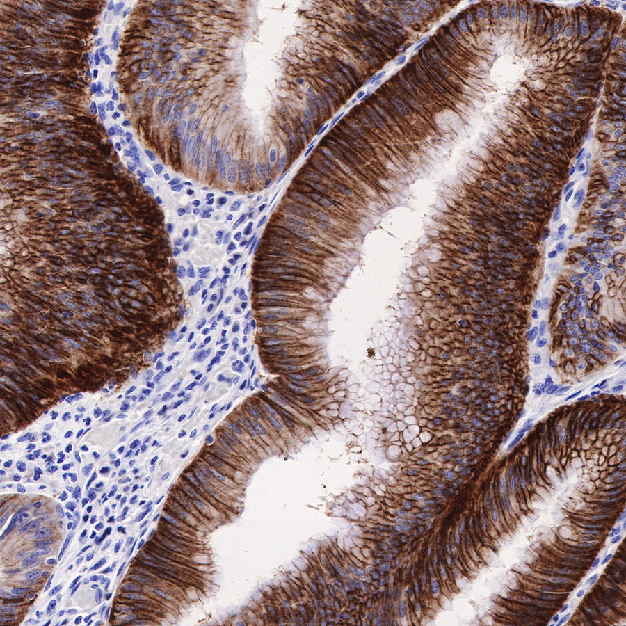 Claudin18.2 + Claudin18.1 Recombinant Rabbit mAb (SDT-298-29)