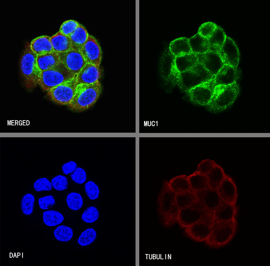 S-RMab® MUC1 Recombinant Rabbit mAb (SDT-776-49)