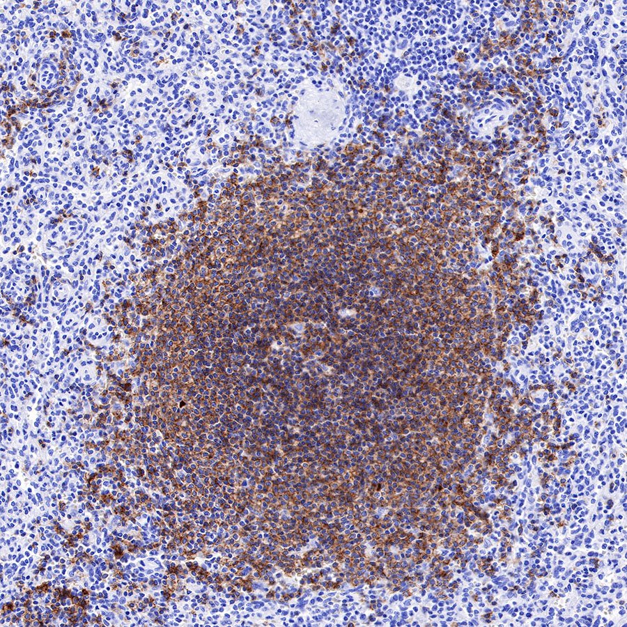Rabbit anti-CD19 Recombinant Monoclonal Antibody(164-33)