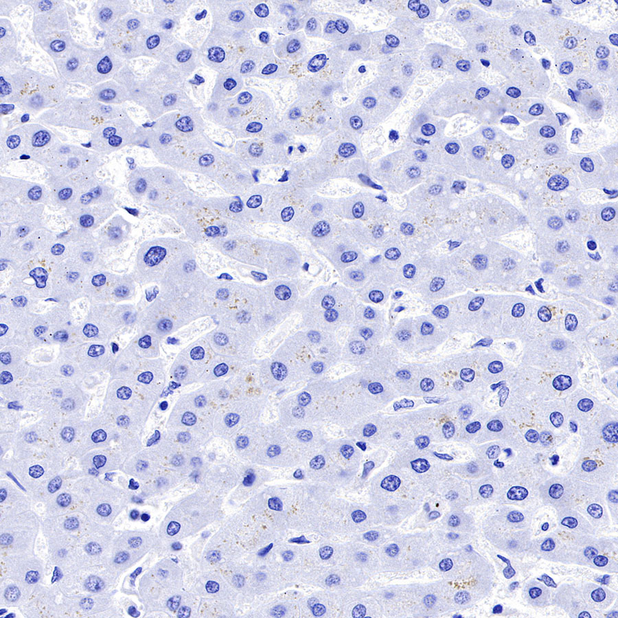 Rabbit anti-CD19 Recombinant Monoclonal Antibody(164-33)