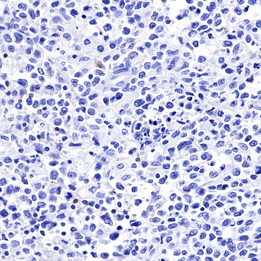 Rabbit anti-CD19 Recombinant Monoclonal Antibody(164-33)