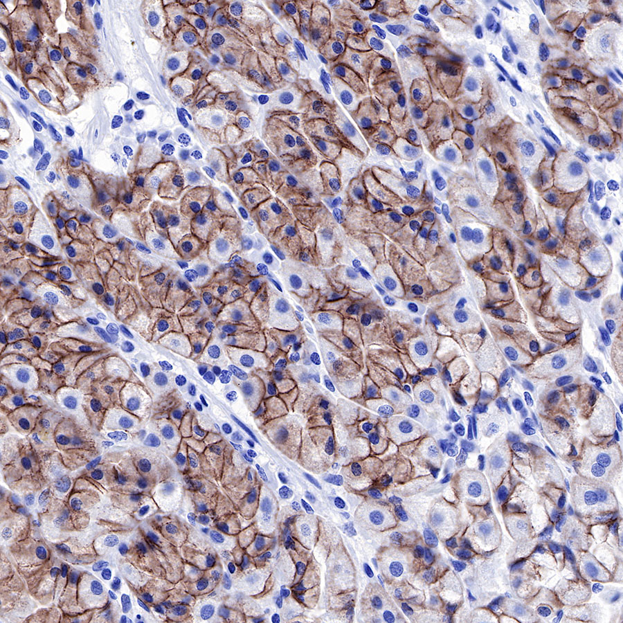 S-RMab® E-Cadherin Recombinant Rabbit mAb,PBS Only (SDT-R088)