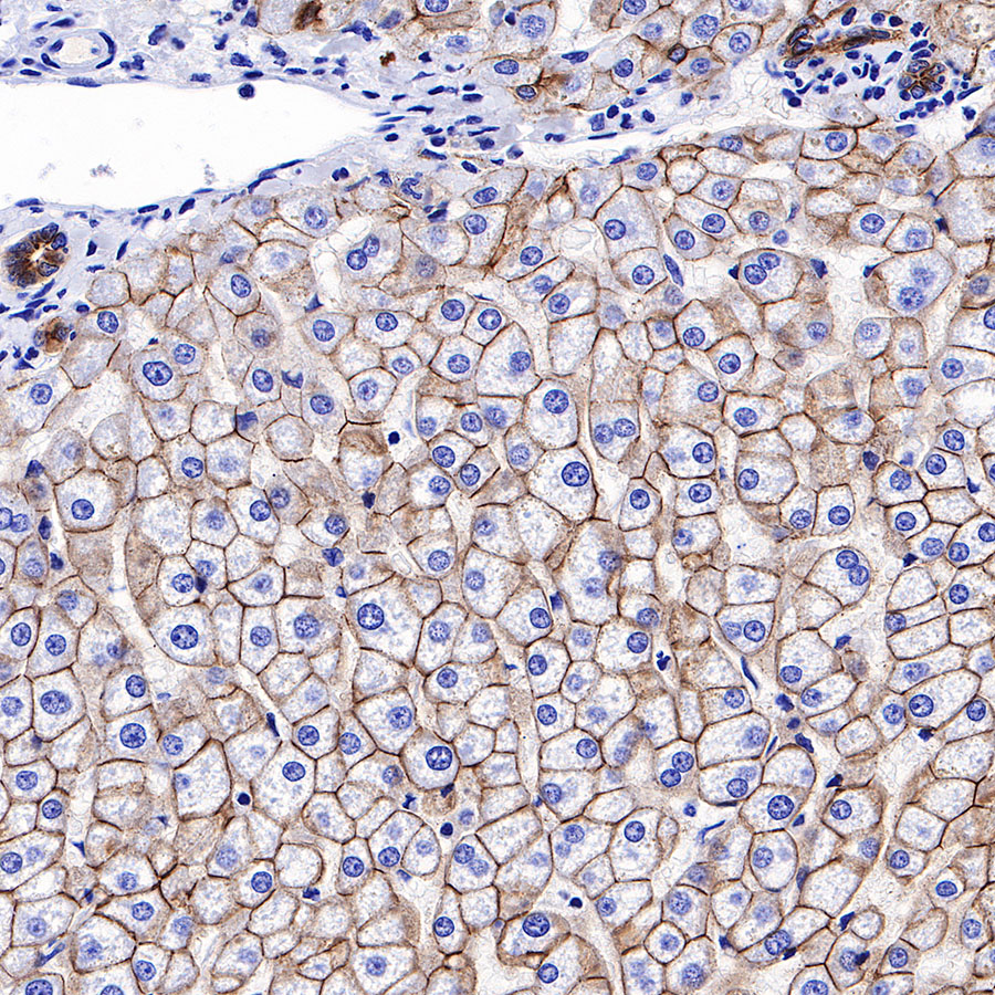S-RMab® E-Cadherin Recombinant Rabbit mAb,PBS Only (SDT-R088)