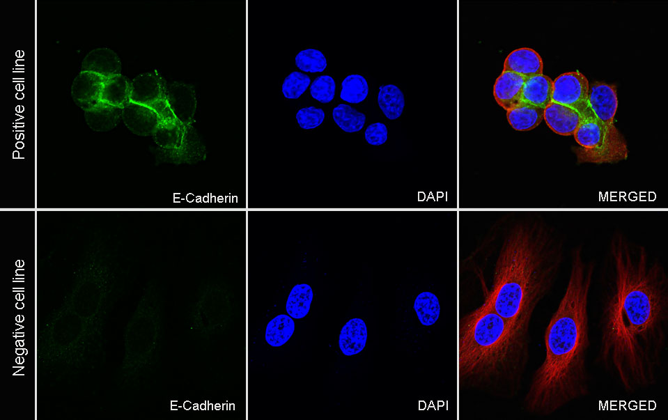 S-RMab® E-Cadherin Recombinant Rabbit mAb,PBS Only (SDT-R088)