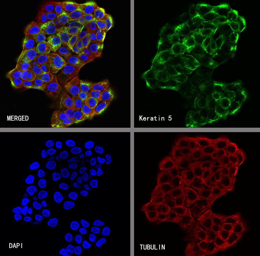Keratin 5 Recombinant Rabbit mAb,PBS Only (SDT-014-67)