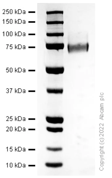 Recombinant Human Thrombomodulin Protein