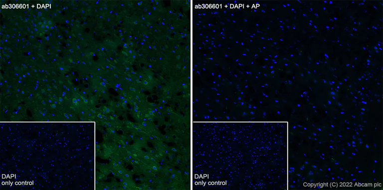 Alexa Fluor® 488 Anti-Tau (phospho T231) antibody [EPR2488]