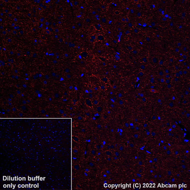Alexa Fluor® 555 Anti-GAD67/GAD1 antibody [EPR20578]